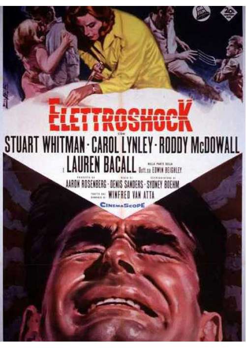 Elettroshock