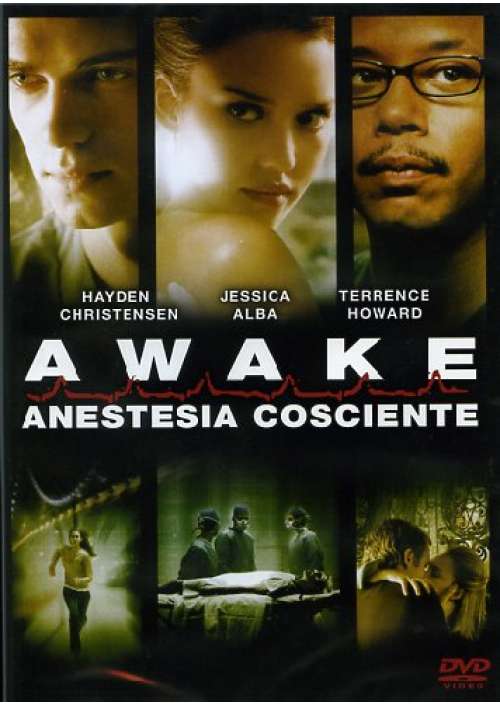 Awake - Anestesia Cosciente